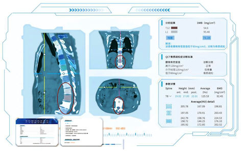 經人工智能檢測，可以清晰地看到骨骼移位的位置。
