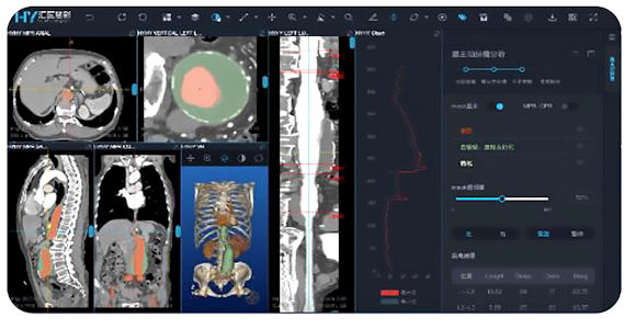 越來越多疾病的診斷和治療評價工作獲得AI技術的支持。
