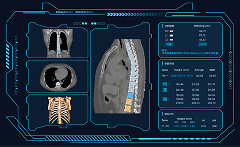 AI可以全面評估脂肪測量、肌肉數據。